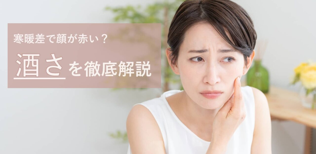 酒さ