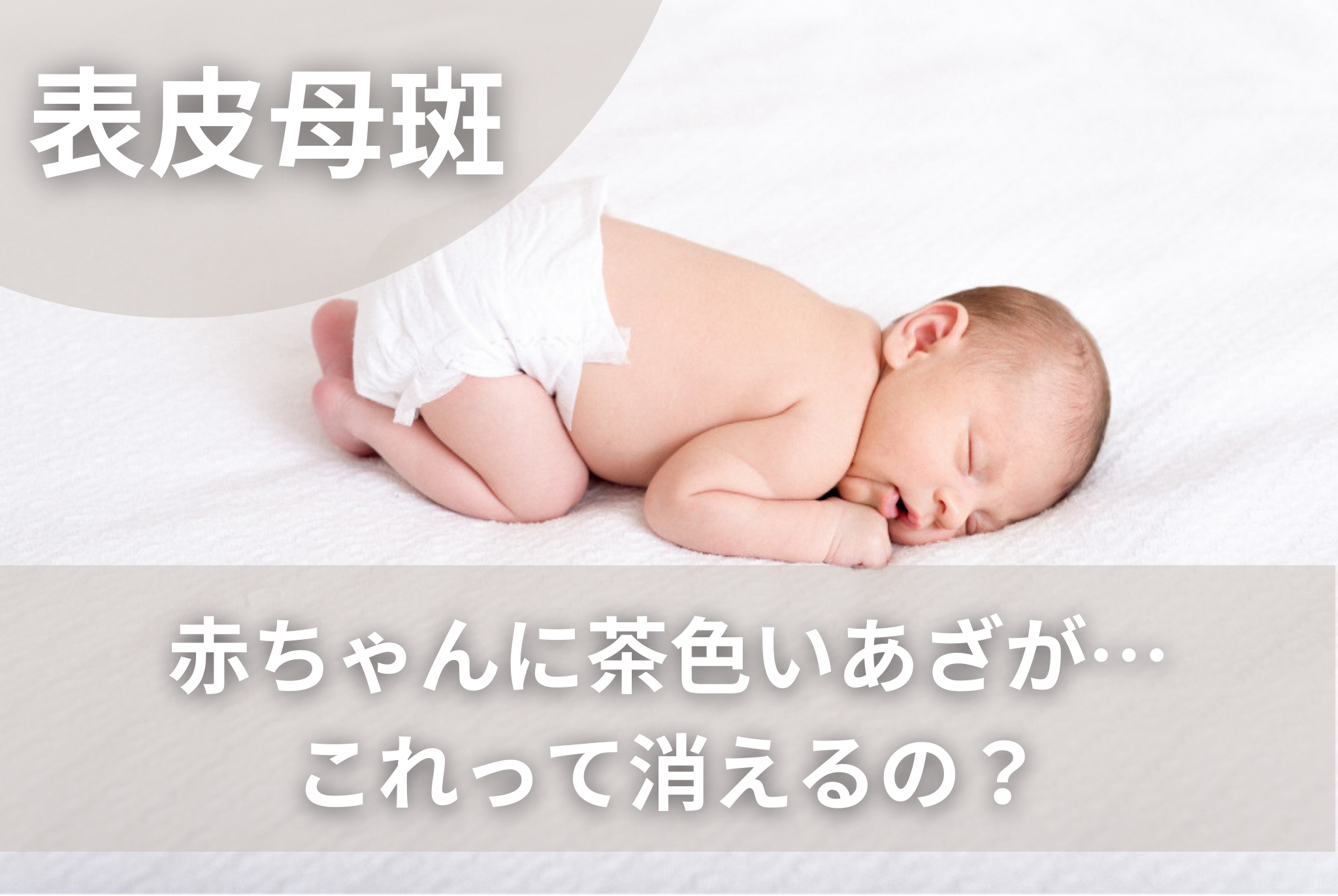 子供の顔にできる茶色いシミの原因と対策まとめ 10 13