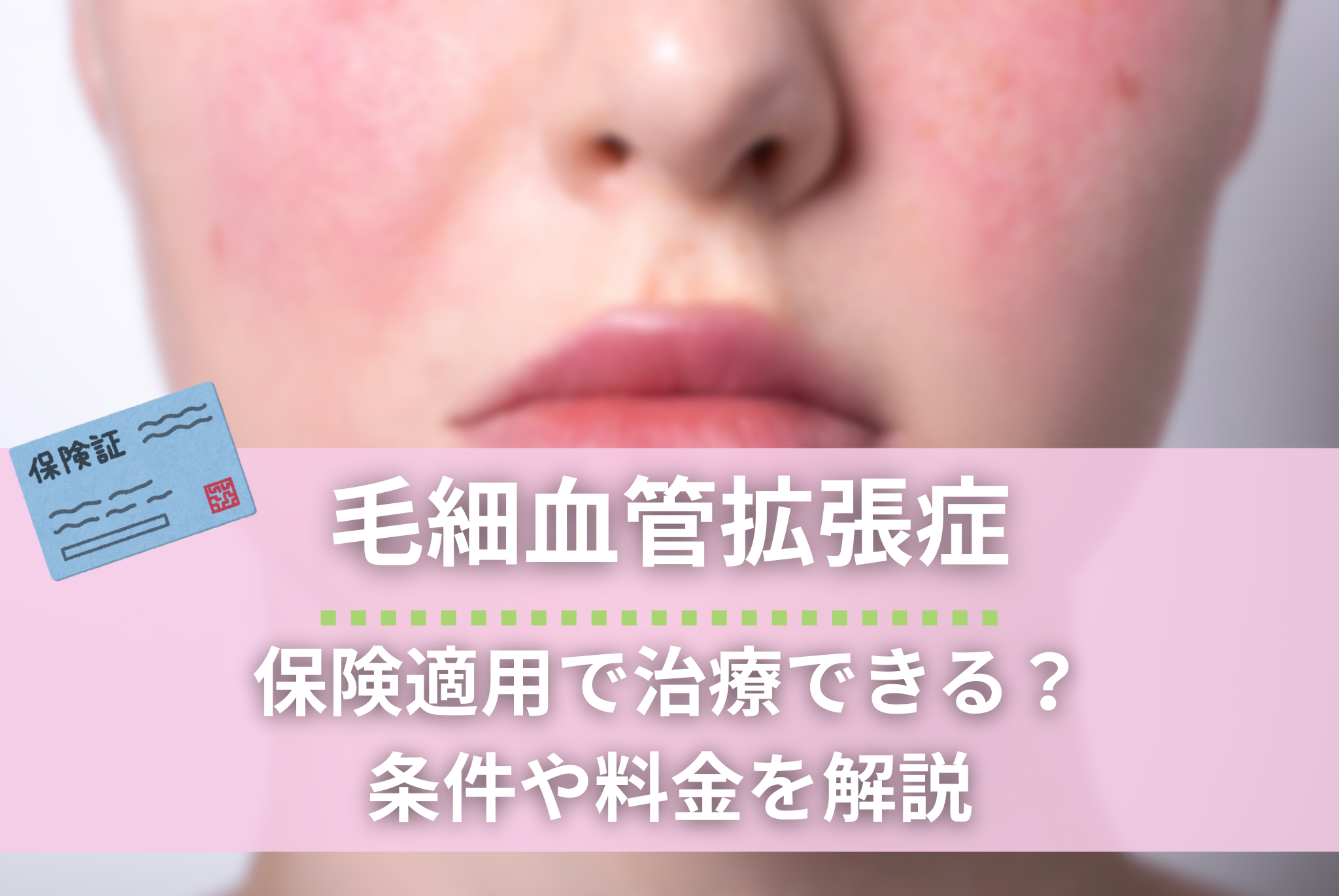 毛細血管拡張症を保険適用で治療できる？条件や料金を解説 | 赤ちゃん